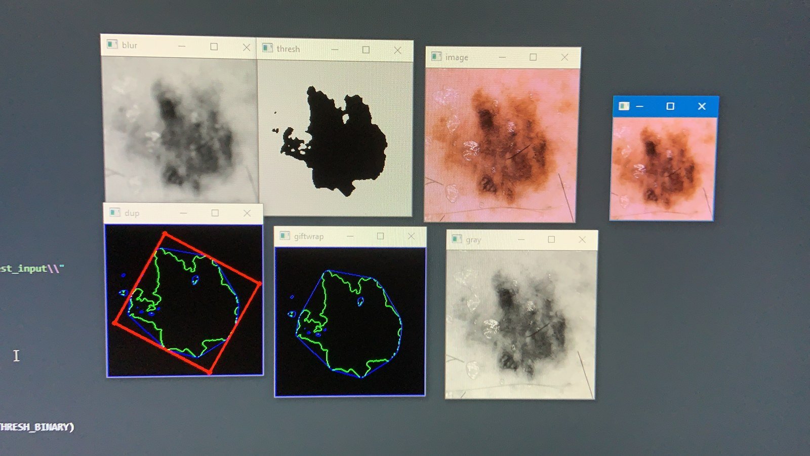 RIDGE lesion classification dataset